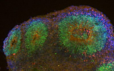 “Mini-Brains” Give  UCSC Researchers Insight