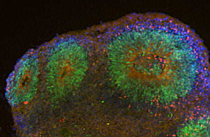 “Mini-Brains” Give  UCSC Researchers Insight